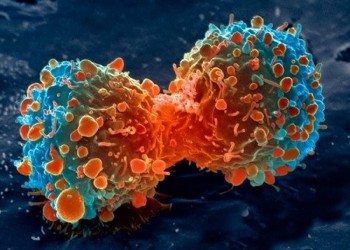 سعودية تسجل براءة اختراع لعلاج الأورام السرطانية من «التمور»
