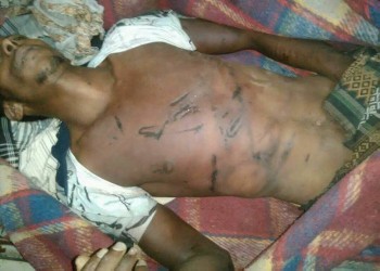 مقتل يمني جراء التعذيب بسجن تديره قوات مدعومة إماراتيا