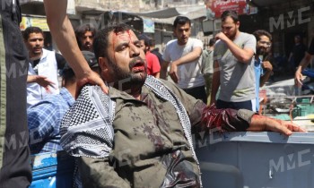 بينهم 5 أطفال.. 14 قتيلا حصيلة قصف النظام السوري وقسد للباب السورية
